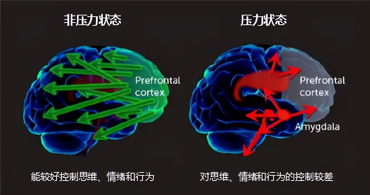 10个“黄金”习惯，让你的头脑保持敏锐，不管你的年纪有多大